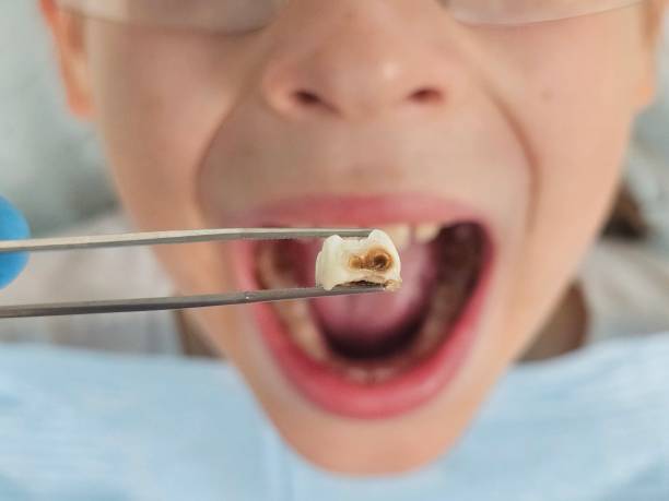 Best Weekend Emergency Dentist in Pittsburg, TX